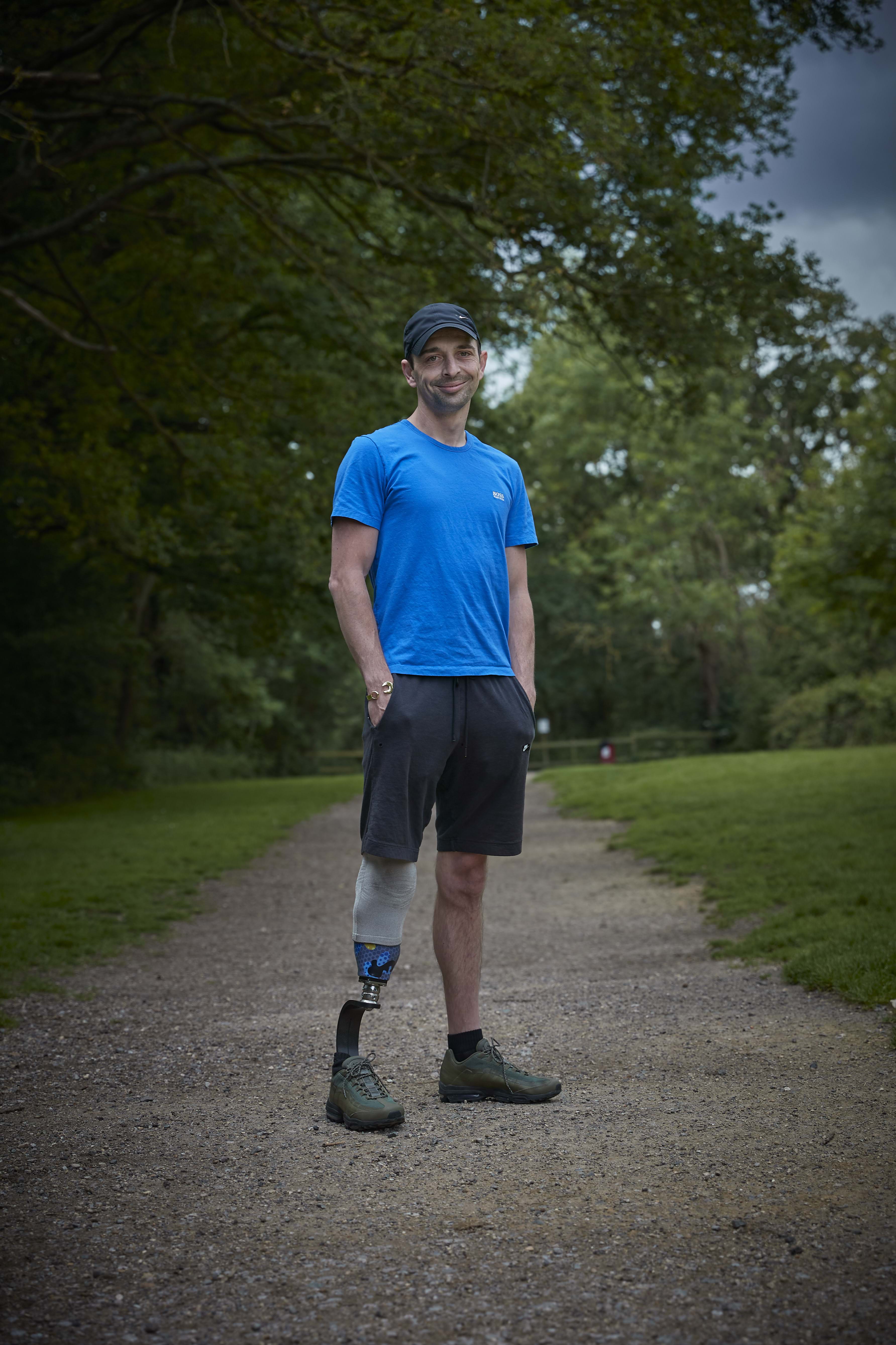 A man stood in a park with a prosthetic leg